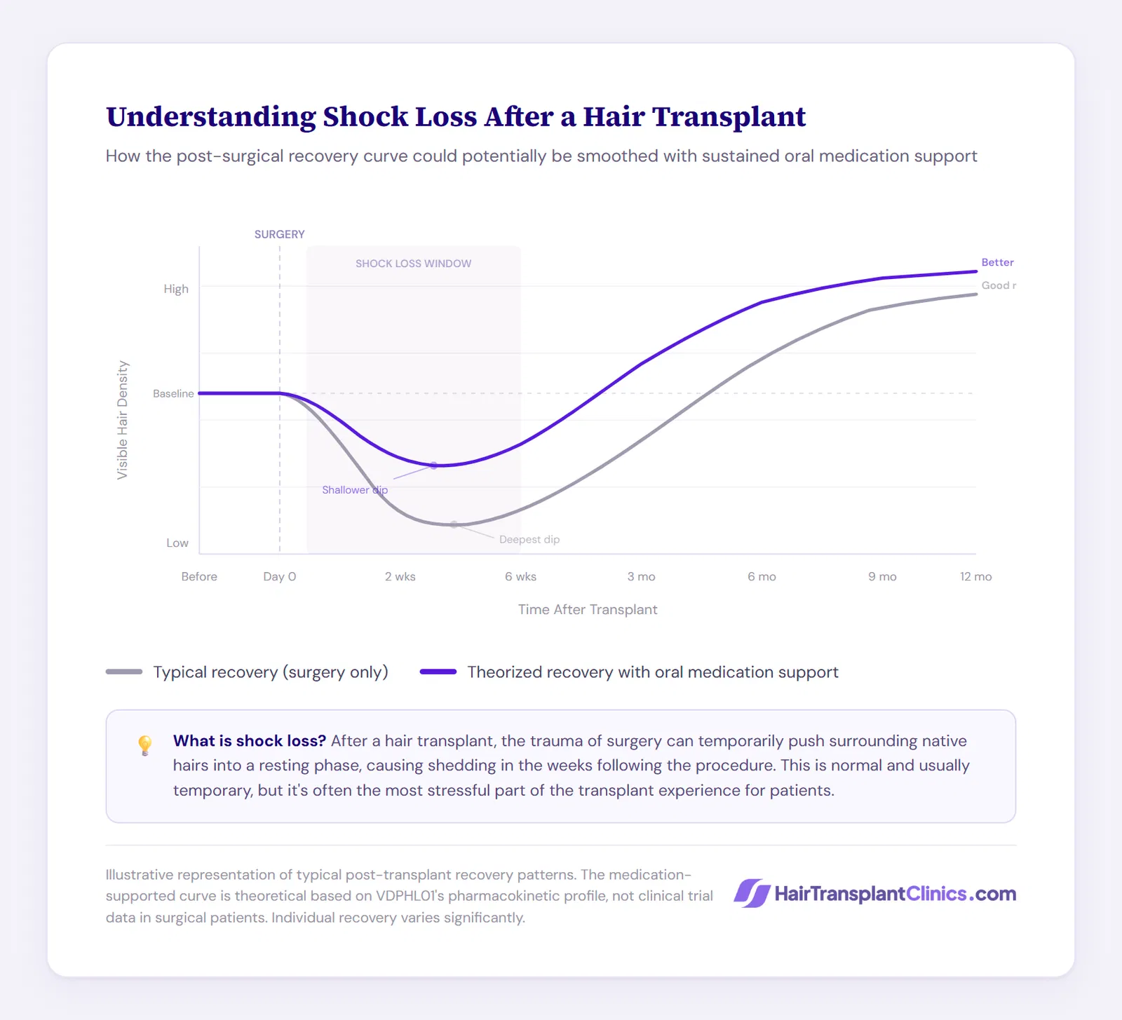 Understanding shock loss after a hair transplant and how oral medication can potentially smooth it