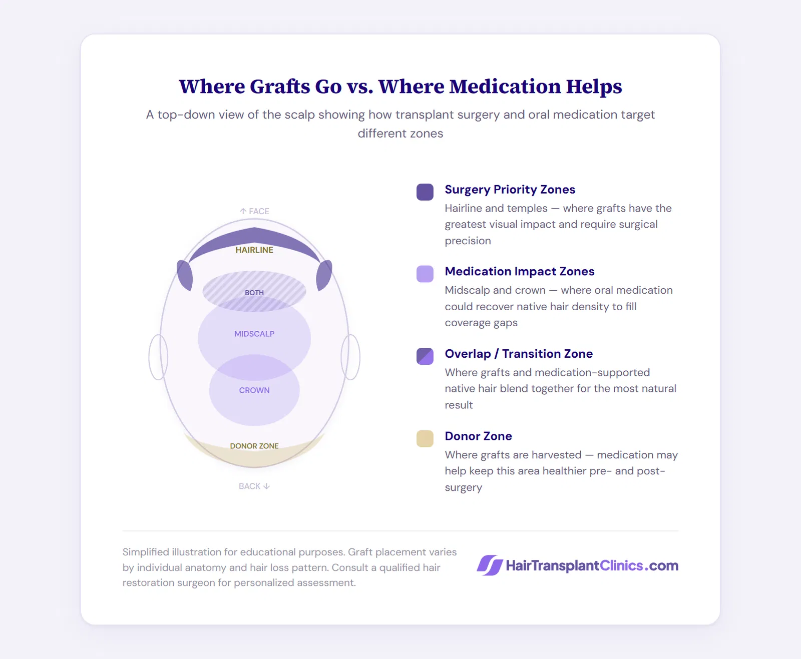 Where grafts go vs. where medication helps